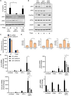 Janus Kinase 1 Is Required for Transcriptional Reprograming of Murine Astrocytes in Response to Endoplasmic Reticulum Stress